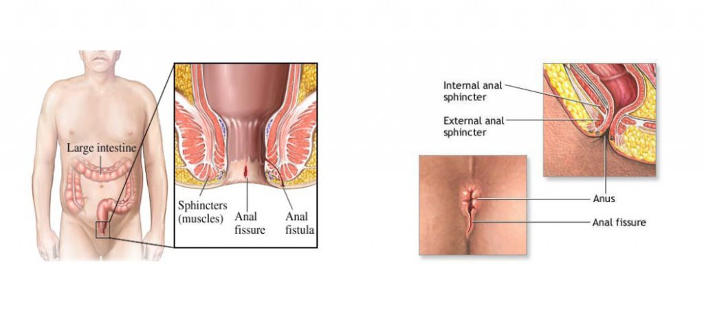 Appendisectomy_Laparoscopic_Jan_2019_001